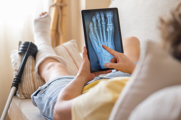 Patient resting an injured foot on a pillow while examining an x-ray on a tablet, sitting on a sofa...