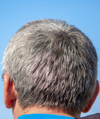 Gray hair on a man, back and side view, close up. Graying man with premature gray hair showing...