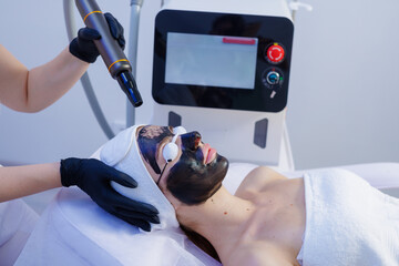Laser Carbon Peeling Facial Treatment for Skin Rejuvenation and Anti Aging in Modern Cosmetic Clinic