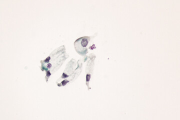 View in microscopic of normal human cervix cells.Glandular epithelial cells shows columnar...