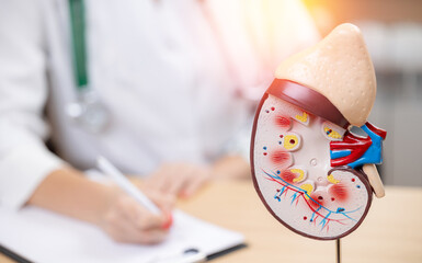 Anatomical model of human kidney in medical office with nephrologist doctor writing in background,...