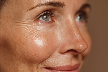wrinkles under the eyes of a middle-aged woman