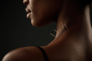 Close-up of a Black woman's neck with acupressure needles in the skin, close-up on her back against a dark background.