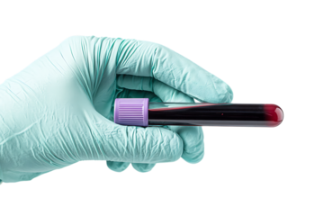 Close up of gloved hand holding blood sample.