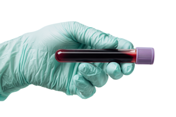 Gloved hand holding a blood sample tube.