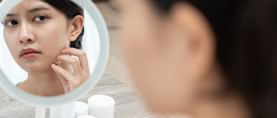 Woman worried about face Dermatology, rosacea dermatitis, allergic steroids, sensitive skin, red...