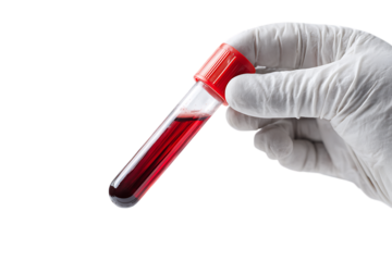 Hand in glove holding a blood sample tube.