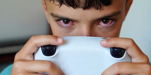 Teenage boy playing video games with console controller and red, irritated eyes. © Inspiraciones