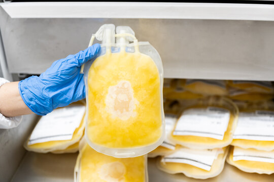Close up scientist hand wear blue gloves holding fresh frozen plasma bag in storage refrigerator at blood bank unit laboratory.Blood bag received from blood donation used in patients.Save life concept