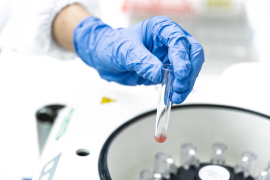 Scientist hand wear blue gloves holding glass blood test tube and reagent into the centrifuge for analysis blood group with blood cross matching for emergency patient at blood bank unit in laboratory.
