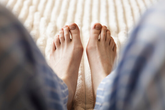 Close-up of female feet with bunions resting on bed at home, Hallux valgus.