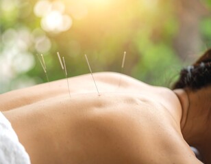 Acupuncture treatment on a woman's back