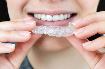 Chica sonriendo y mostrando férula con gel blanqueador cerca de su boca. Blanqueamiento dental...