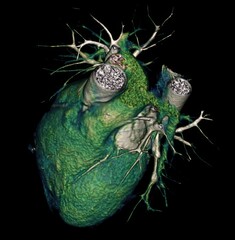3D CT Scan Visualization of Human Heart and Vascular System