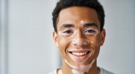 Close-up portrait of a smiling young man with vitiligo, showcasing his unique skin and positive expression.