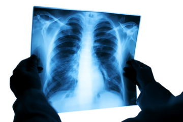Close up of a doctor reviewing a chest X ray.