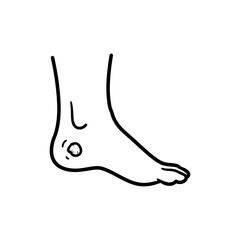 Diabetic Foot Ulcer Icon for Diabetes-Related Health Conditions
