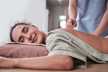 Oriental healing, Hispanic woman patient with acupuncture treatment, hand procedure on back by...