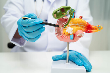 Liver with gallbladder, pancreas spleen and duodenum, Asian doctor holding human anatomy model for study diagnosis and treatment in hospital.