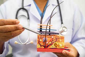 Hair transplant, Asian dermatologist doctor holding skin structure anatomy model for treatment in...