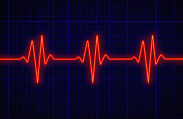 EKG readout displays irregular heartbeat during potential heart attack. Red glowing line on blue grid monitors vital signs in intensive care unit. Cardiology data shows arrhythmia, indicating