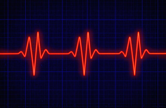 EKG readout displays irregular heartbeat during potential heart attack. Red glowing line on blue grid monitors vital signs in intensive care unit. Cardiology data shows arrhythmia, indicating