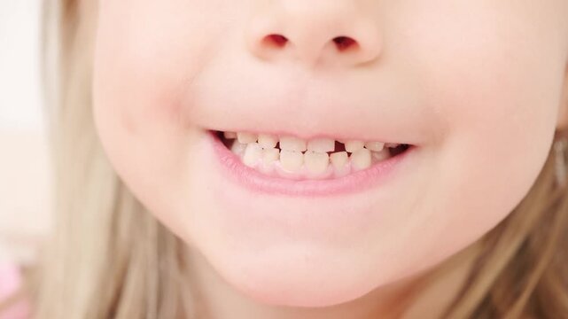 Child proudly shows mixed teeth, baby and permanent, girl preschooler shows new teeth growing, pediatric dentistry, dental milestone, natural process growing up, childhood changing day by day