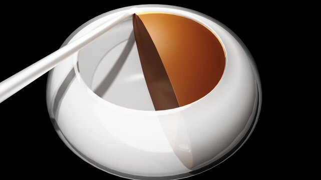 Advanced Phaco Chop with Sustainer Method in Cataract Surgery