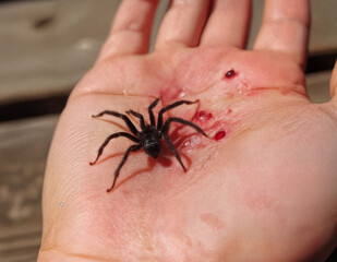 Obraz premium Close-up of a tarantula on a human palm with visible bite marks and blood, showcasing the thrill and danger of handling exotic spiders, perfect for educational and wildlife content.