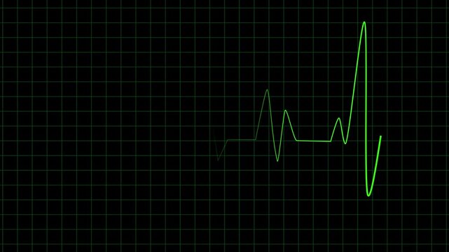 Medical heartbeat monitor animation. Green EKG pulse cardiology data rhythm technology loop. Looping ECG pulse animation. Healthcare medical visualization abstract graphic design element.