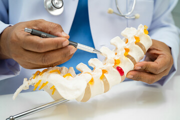 Doctor with lumbar vertebra bone skeleton and nerve model for treatment in the orthopedic...