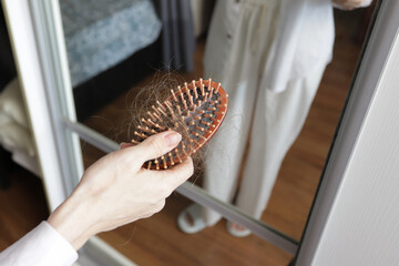 Hair Loss on Comb After Brushing, Hand Holding Fallen Hair at Home