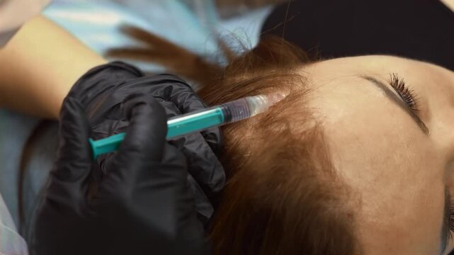Female dermatologist skillfully administering steroid injection into the scalp. Trichology treatment aimed at reducing inflammation and supporting hair follicle health. Precision cosmetic care to