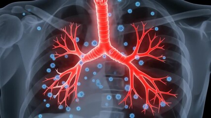 Medical animation showing blue virus particles infecting the human lungs and bronchial tubes within a transparent chest X-ray - Powered by Adobe