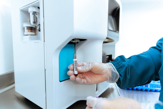 Automated Blood Sample Processing in Hematology Analyzer by Gloved Technician