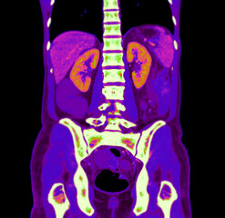High-resolution abdominal CT image highlighting vascular and organ anatomy with intense color mapping.