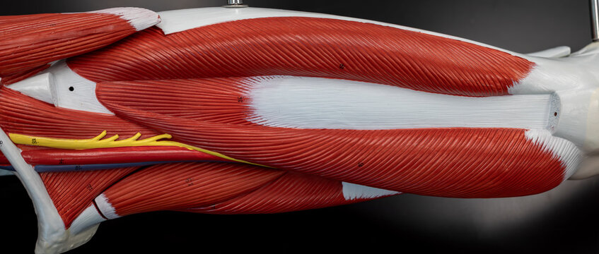 Anterior Thigh Dissection Showing Vastus Intermedius With Rectus Femoris Removed