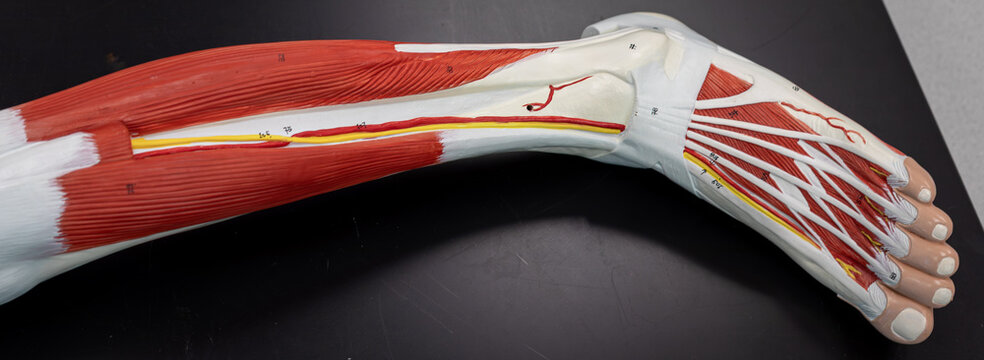Leg Dissection Showing Tibial Division Of Sciatic Nerve With Extensor Digitorum Longus Removed