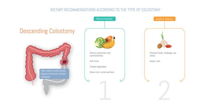 Dietary recommendations for colostomy patients illustrated