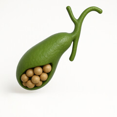 3D medical illustration of human gallbladder with multiple gallstones and biliary duct anatomy on white background for health education and medical presentation