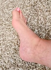 Female Foot with Pink Toenail Polishon a White Carpet 