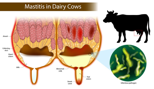 Detailed medical illustration of mastitis in dairy cows, showing a cross-section of a healthy and infected udder. Cow Mastitis with Pathogen and Abnormal Milk