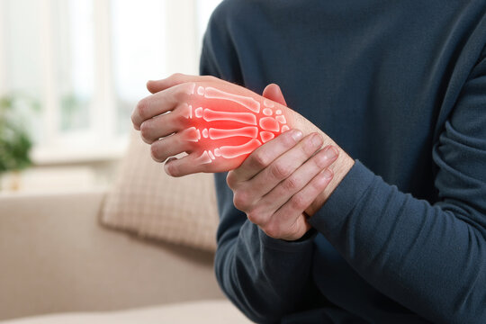 Arthritis. Man suffering from pain in hand indoors, closeup. Illustration of joint inflammation
