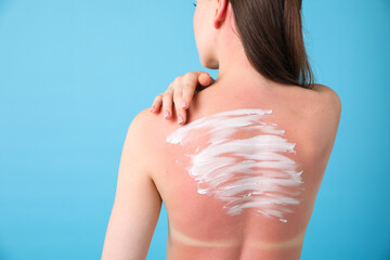 Fototapeta premium Woman with sun protection product on her sunburned skin against light blue background, back view. Space for text