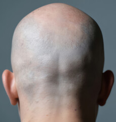 Naklejka premium Close-up back view of a bald man head against a plain grey background. His smooth scalp, defined shape, and the subtle texture are the main focus in this clean, minimalistic, and calm portrait.