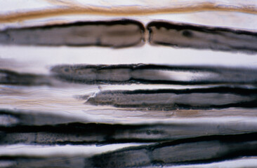 Myelinated nerve fiber. Schmidt-Lanterman clefts
