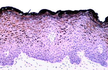 Human vagina. Cytokeratin
