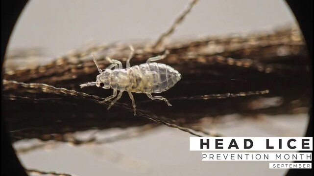 Head lice prevention month. live lice video.