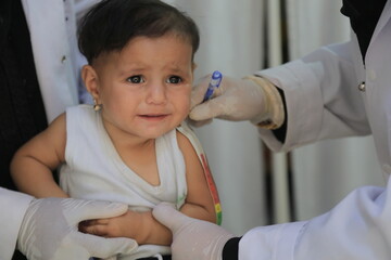 A doctor examines children's malnutrition inside a refugee camp. Malnutrition was measured using a...