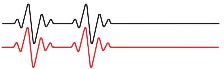 Red heartbeat cardiogram on a medical monitor illustrating health and finance trends